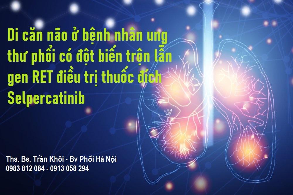 HIỆU QUẢ ĐỐI VỚI HỆ THẦN KINH CỦA THUỐC ĐÍCH SELPERCATINIB