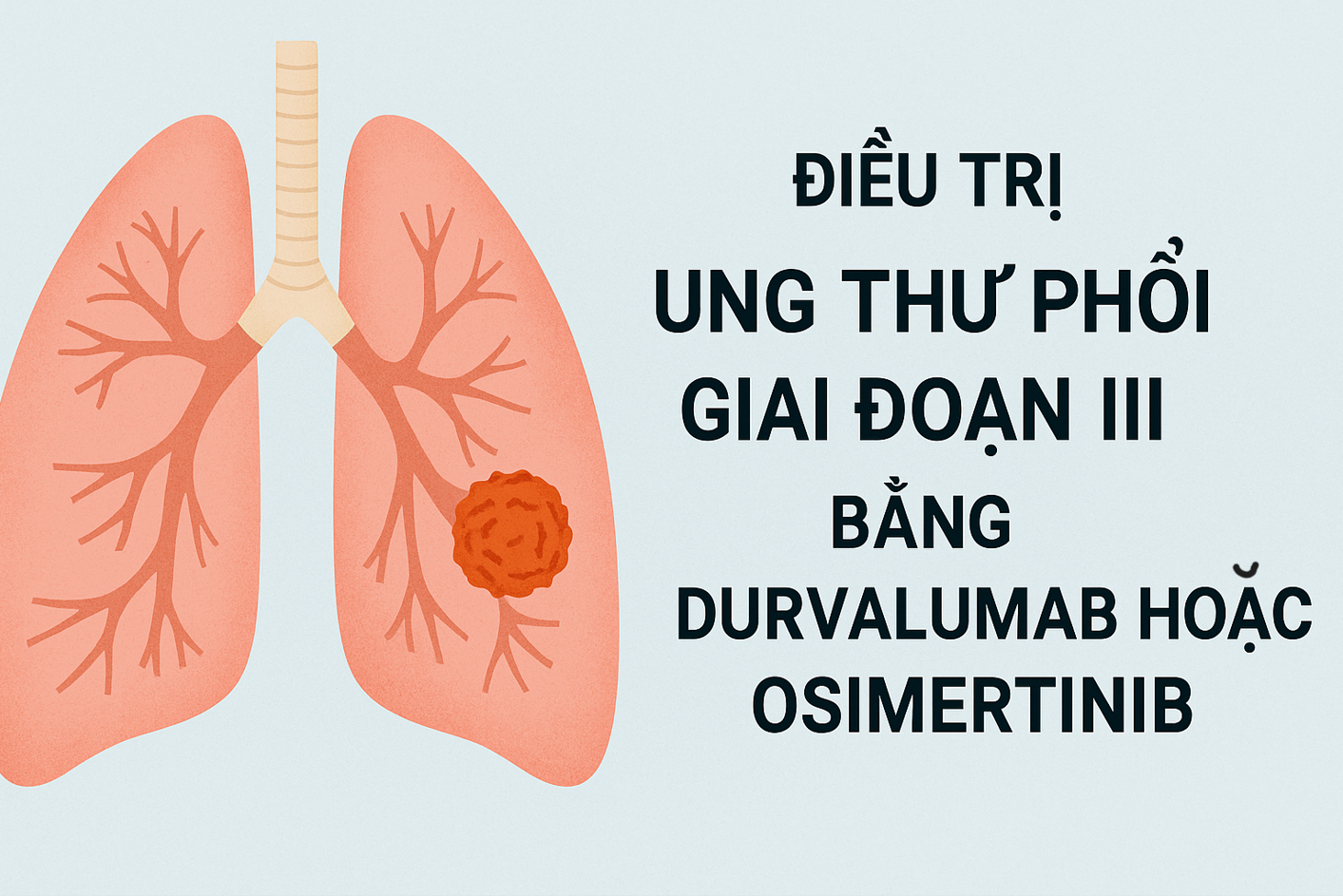 Thuốc đích và miễn dịch: Cách kéo dài sống thêm ở ung thư phổi giai đoạn 3