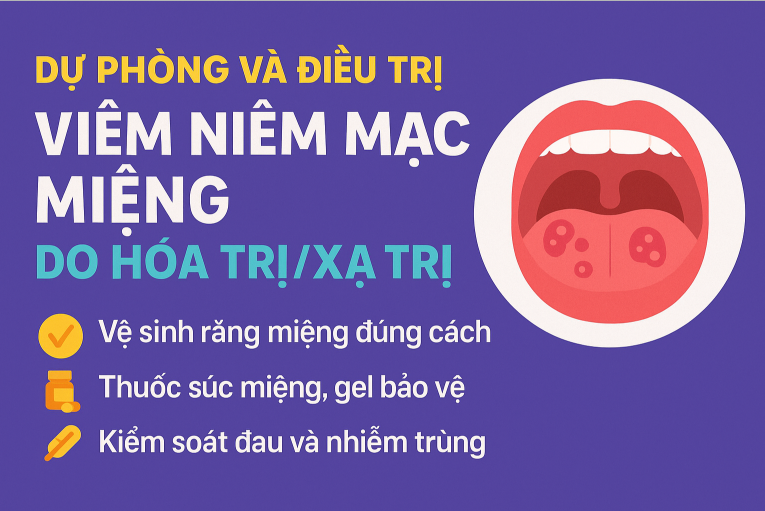 Viêm Niêm Mạc Miệng Trong Xạ Trị và Hóa Trị Liều Cao