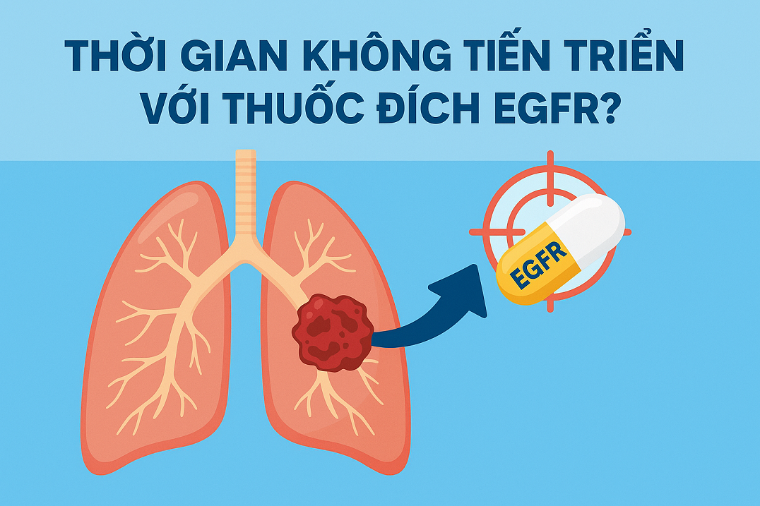 Hiệu Quả Thời Gian Sống Thêm Không Tiến Triển (PFS) Của Thuốc Đích EGFR Trong Ung Thư Phổi Giai Đoạn 4