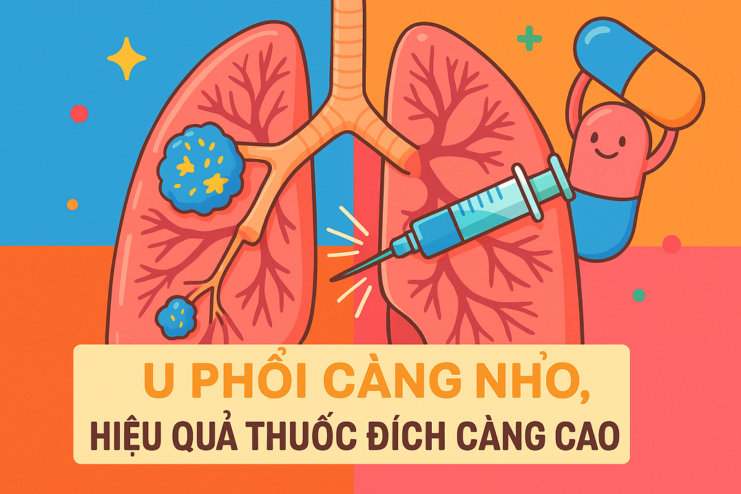 Khối u giảm càng nhiều, sống càng lâu: Giá trị tiên lượng trong điều trị ung thư phổi đột biến EGFR