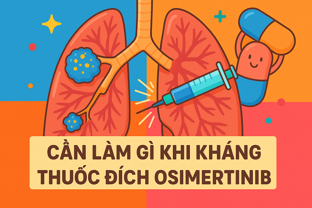 Cần làm gì khi bị kháng thuốc Osimertinib điều trị ung thư phổi giai đoạn 4?