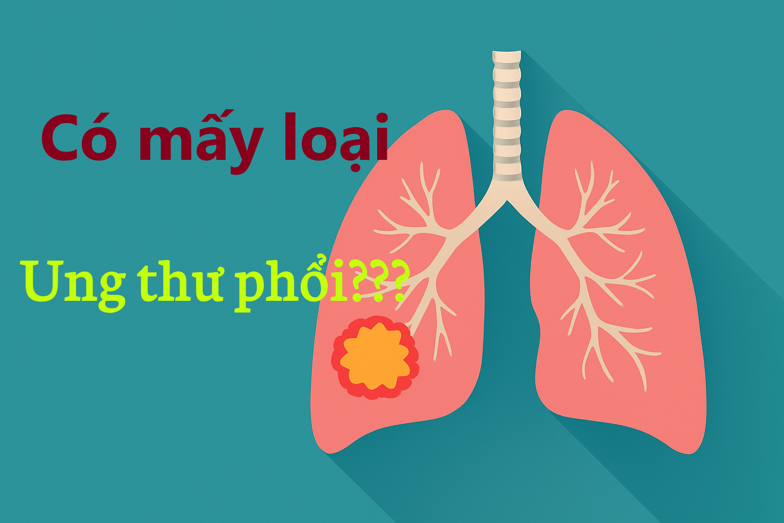 Các loại ung thư phổi thường gặp và cách phân biệt chính xác
