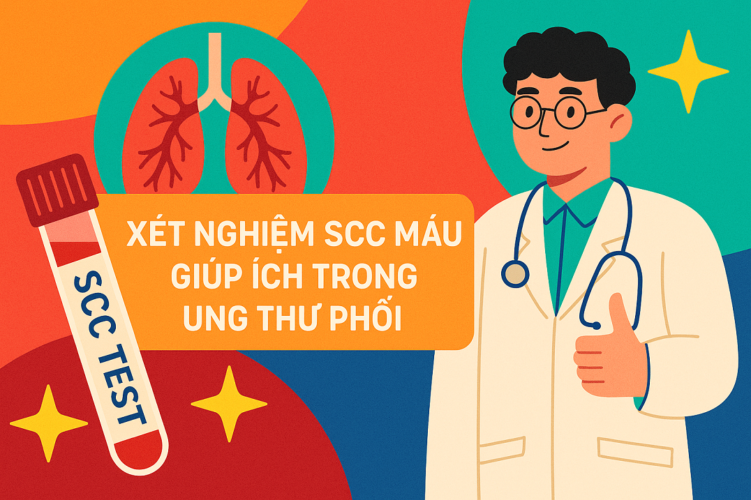Vai trò của xét nghiệm SCC máu trong ung thư phổi: Những điều bạn cần biết