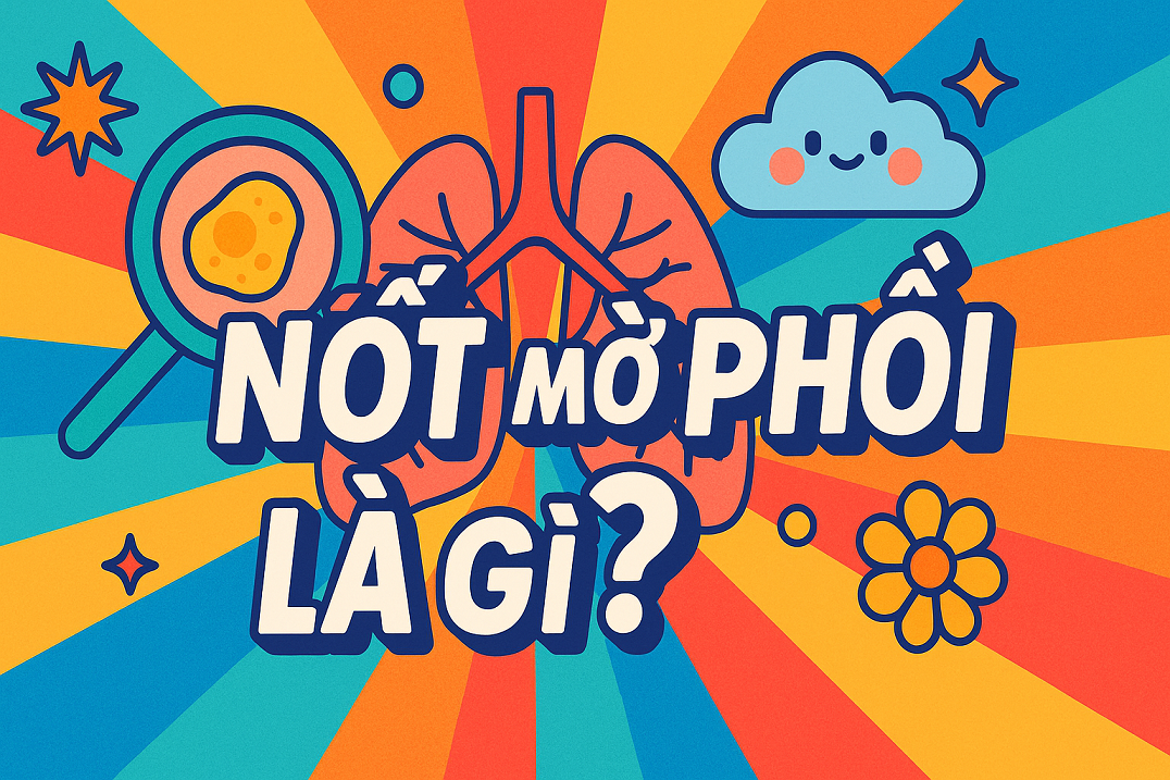 Nốt mờ phổi là gì? Phân loại, nguyên nhân và cách xử lý an toàn từ bác sĩ chuyên khoa
