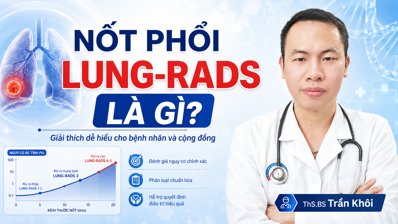 LUNG-RADS: Hướng dẫn an toàn cho phát hiện nốt phổi